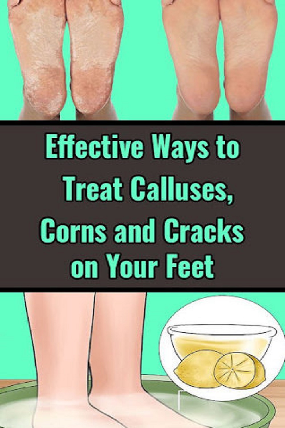 effective-ways-to-treat-calluses-corns-and-cracks-on-your-feet